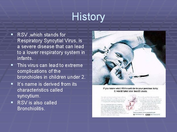 History § RSV , which stands for § § § Respiratory Syncytial Virus, is History § RSV , which stands for § § § Respiratory Syncytial Virus, is
