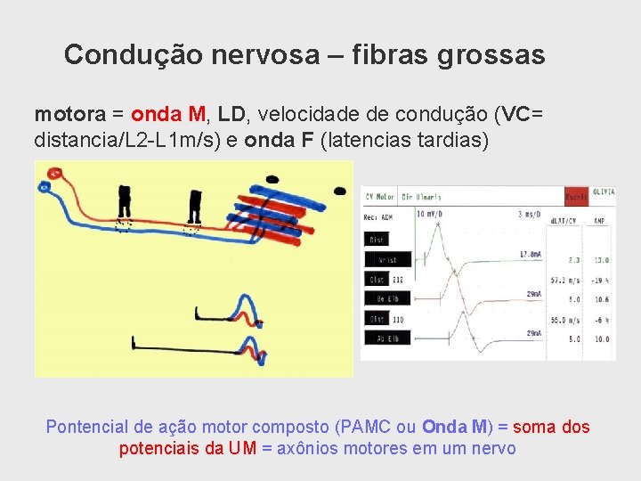 Condução nervosa – fibras grossas motora = onda M, LD, velocidade de condução (VC=