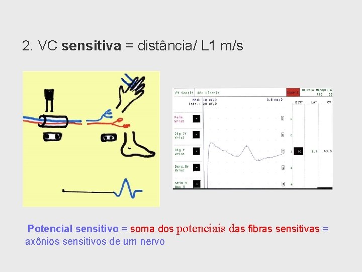 2. VC sensitiva = distância/ L 1 m/s Potencial sensitivo = soma dos potenciais