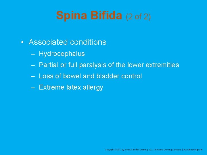 Spina Bifida (2 of 2) • Associated conditions – Hydrocephalus – Partial or full