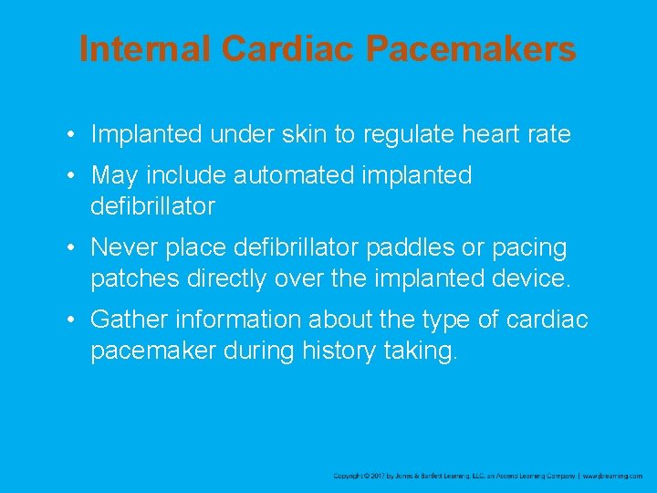 Internal Cardiac Pacemakers • Implanted under skin to regulate heart rate • May include