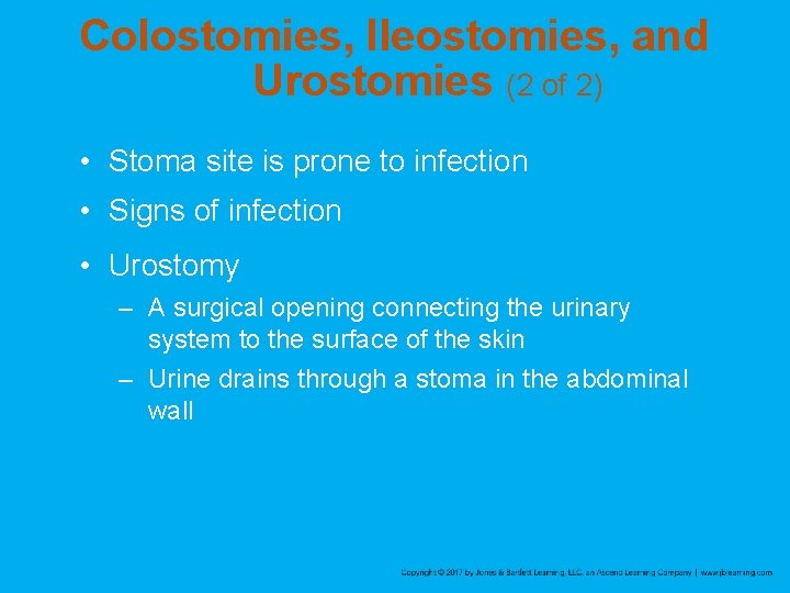 Colostomies, Ileostomies, and Urostomies (2 of 2) • Stoma site is prone to infection