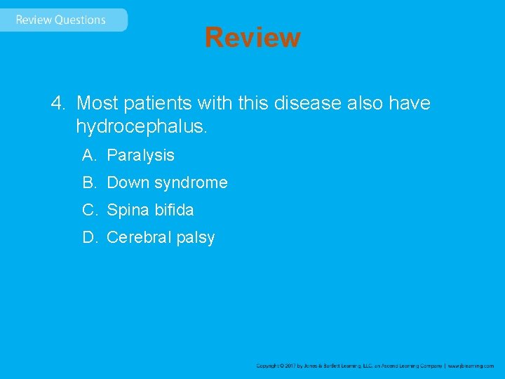 Review 4. Most patients with this disease also have hydrocephalus. A. Paralysis B. Down