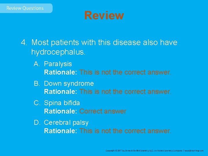 Review 4. Most patients with this disease also have hydrocephalus. A. Paralysis Rationale: This