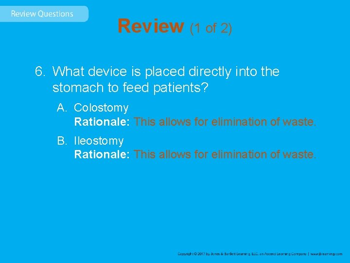 Review (1 of 2) 6. What device is placed directly into the stomach to