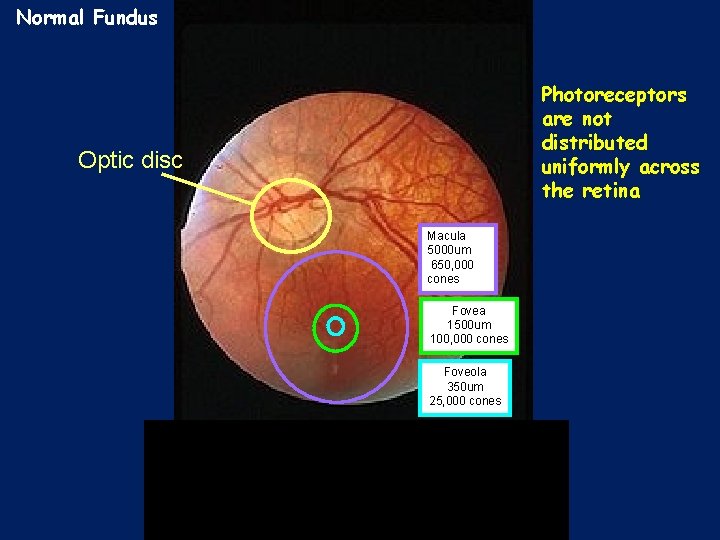 Normal Fundus Photoreceptors are not distributed uniformly across the retina Optic disc Macula 5000