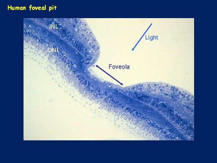 Human foveal pit INL Light ONL Foveola 