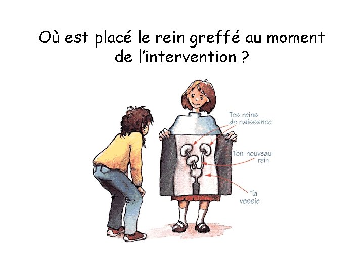 Où est placé le rein greffé au moment de l’intervention ? 