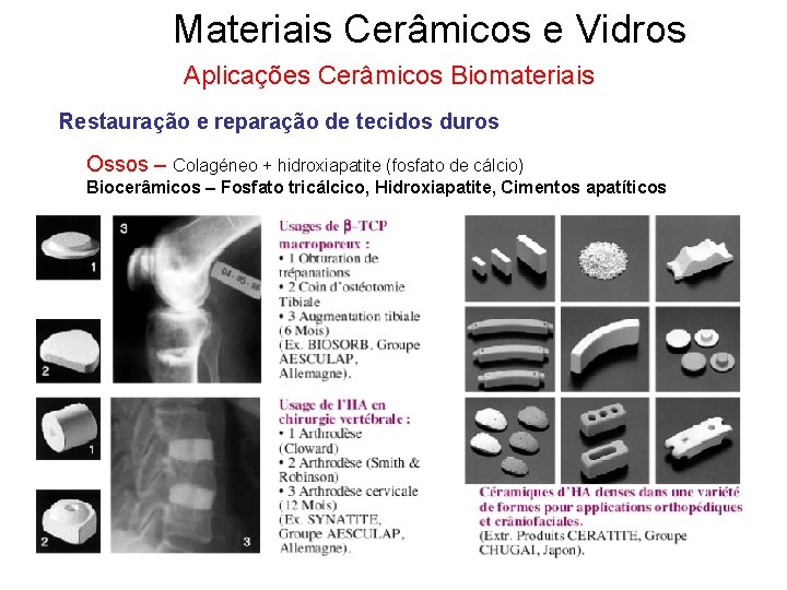 Materiais Cerâmicos e Vidros Aplicações Cerâmicos Biomateriais Restauração e reparação de tecidos duros Ossos Materiais Cerâmicos e Vidros Aplicações Cerâmicos Biomateriais Restauração e reparação de tecidos duros Ossos
