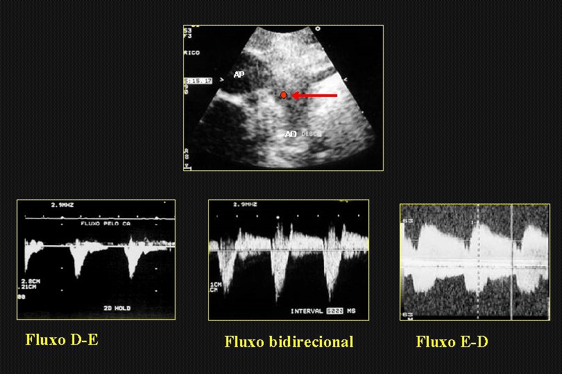 AP AO Fluxo D-E Fluxo bidirecional Fluxo E-D 