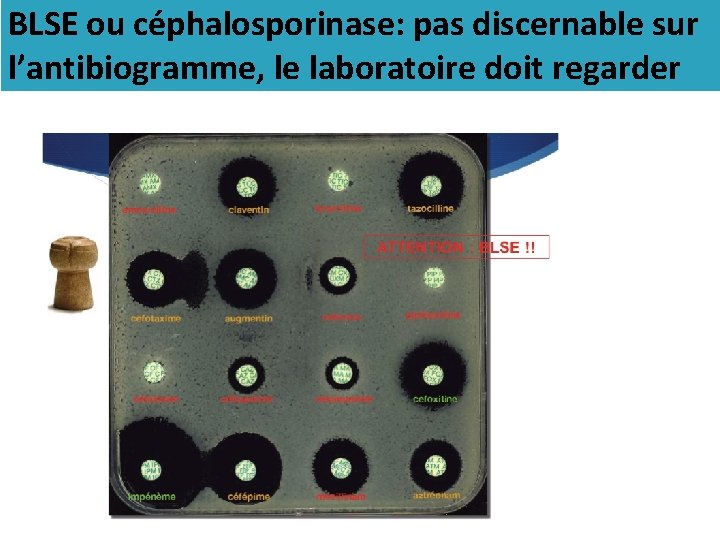 BLSE ou céphalosporinase: pas discernable sur l’antibiogramme, le laboratoire doit regarder 