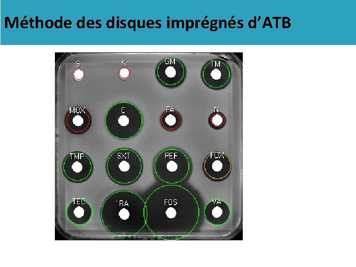 Méthode des disques imprégnés d’ATB 