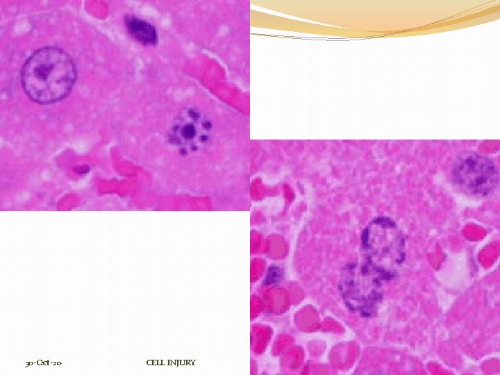 30 -Oct-20 CELL INJURY 12 