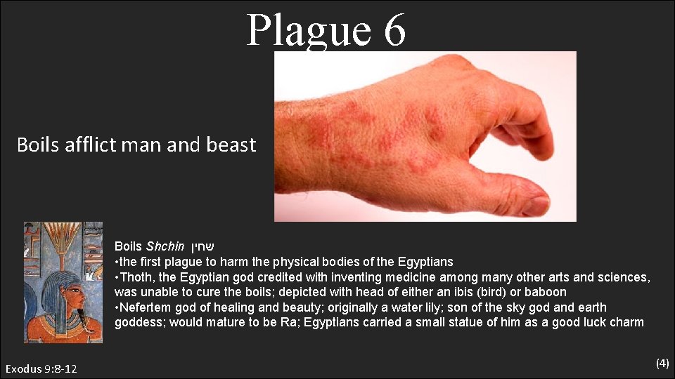 Plague 6 Boils afflict man and beast Boils Shchin שחין • the first plague