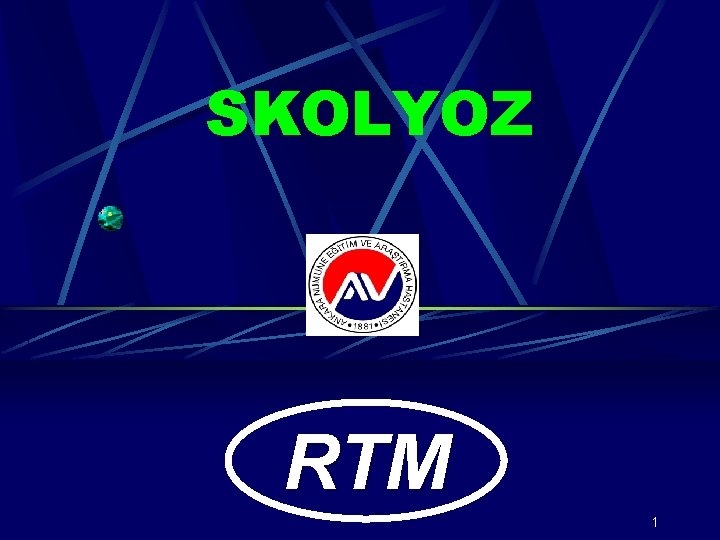 SKOLYOZ RTM 1 