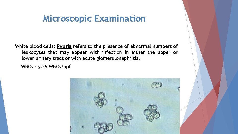 Microscopic Examination White blood cells: Pyuria refers to the presence of abnormal numbers of