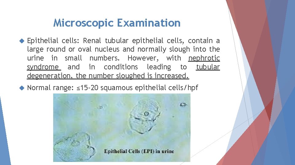 Microscopic Examination Epithelial cells: Renal tubular epithelial cells, contain a large round or oval