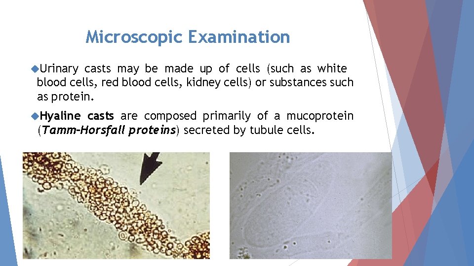 Microscopic Examination Urinary casts may be made up of cells (such as white blood