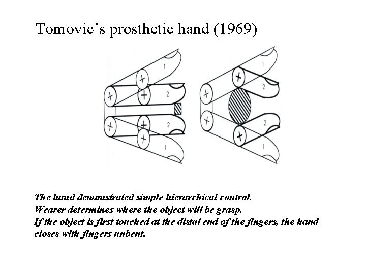 Tomovic’s prosthetic hand (1969) The hand demonstrated simple hierarchical control. Wearer determines where the