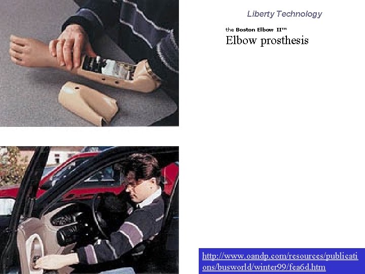 Liberty Technology the Boston Elbow II™ Elbow prosthesis http: //www. oandp. com/resources/publicati ons/busworld/winter 99/fea