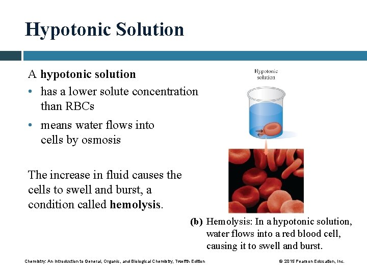 Hypotonic Solution A hypotonic solution • has a lower solute concentration than RBCs •
