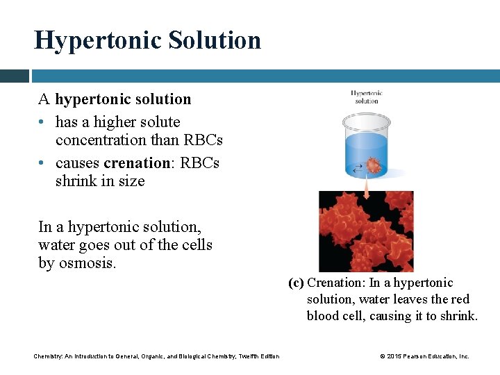 Hypertonic Solution A hypertonic solution • has a higher solute concentration than RBCs •