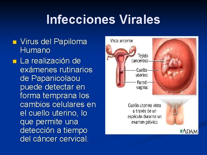 Infecciones Virales n n Virus del Papiloma Humano La realización de exámenes rutinarios de