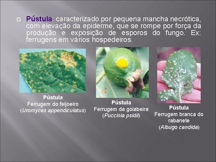  Pústula: caracterizado por pequena mancha necrótica, com elevação da epiderme, que se rompe