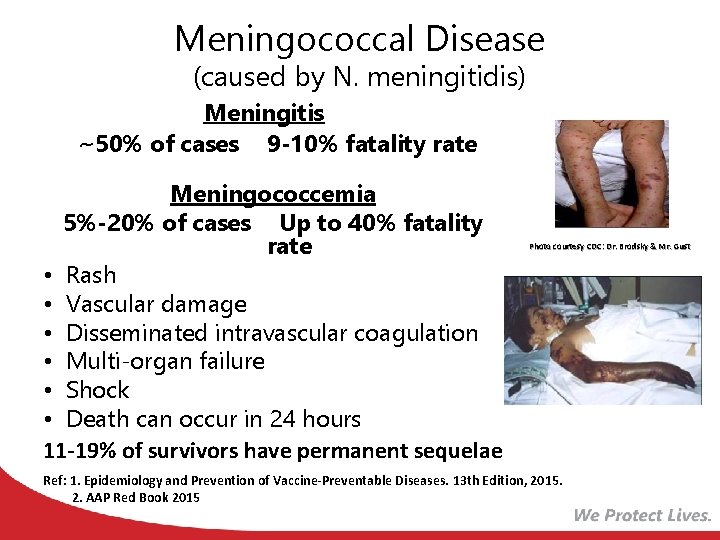 Meningococcal Disease (caused by N. meningitidis) Meningitis ~50% of cases 9 -10% fatality rate