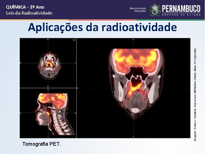 QUÍMICA - 2º Ano Leis da Radioatividade Tomografia PET. Imagem: Sanko / Creative Commons
