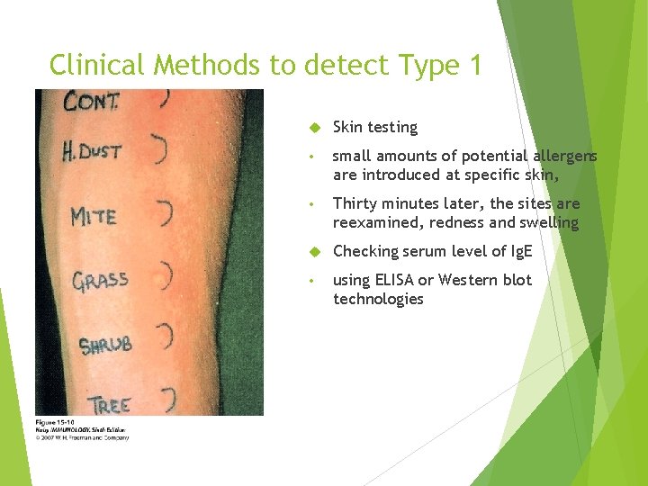 Clinical Methods to detect Type 1 Skin testing • small amounts of potential allergens Clinical Methods to detect Type 1 Skin testing • small amounts of potential allergens