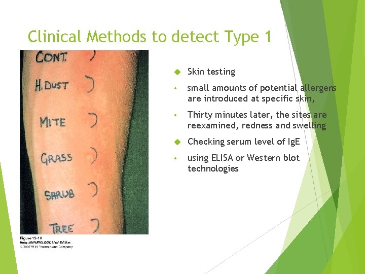 Clinical Methods to detect Type 1 Skin testing • small amounts of potential allergens