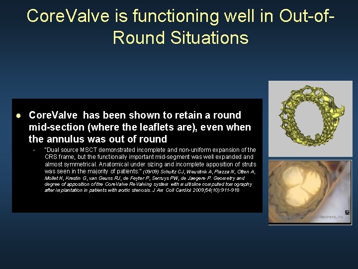 Core. Valve is functioning well in Out-of. Round Situations ● Core. Valve has been