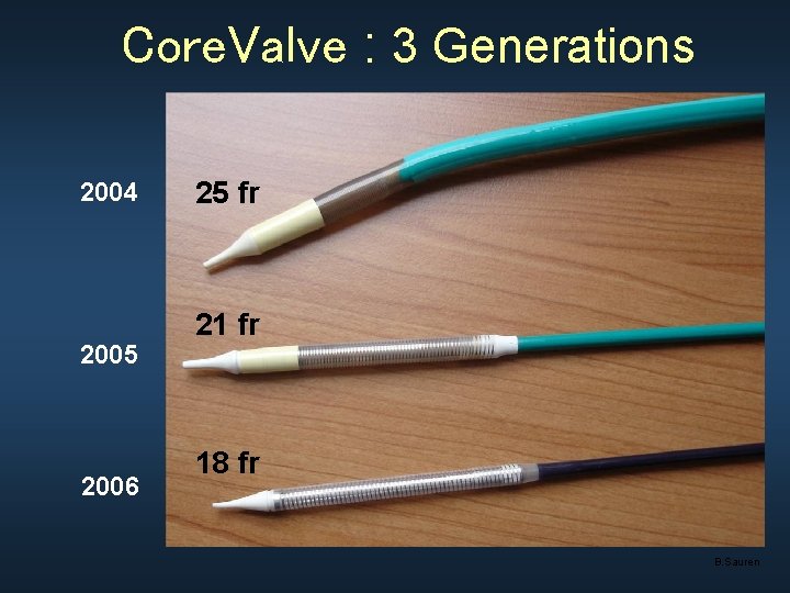 Core. Valve : 3 Generations 2004 2005 2006 25 fr 21 fr 18 fr