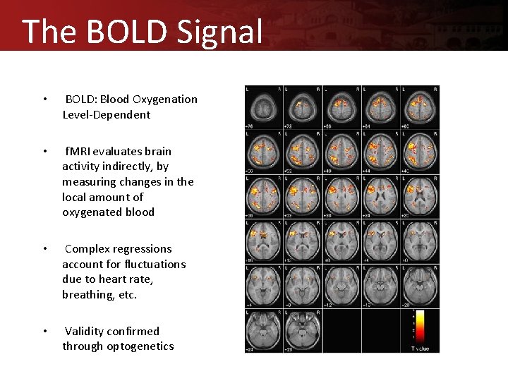 The BOLD Signal • BOLD: Blood Oxygenation Level-Dependent • f. MRI evaluates brain activity