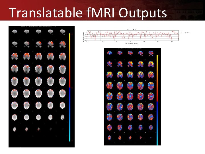Translatable f. MRI Outputs 