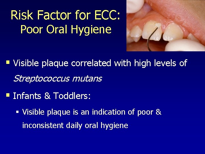 Risk Factor for ECC: Poor Oral Hygiene § Visible plaque correlated with high levels