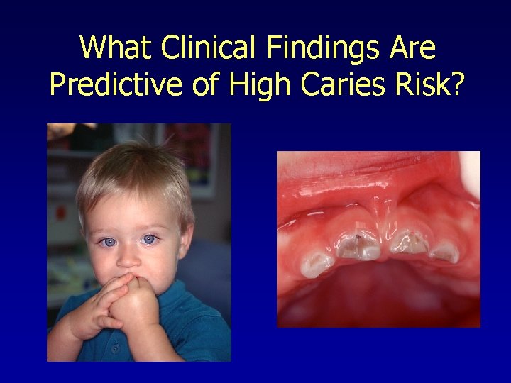 What Clinical Findings Are Predictive of High Caries Risk? 