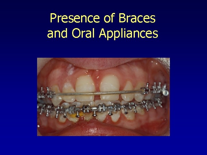 Presence of Braces and Oral Appliances 