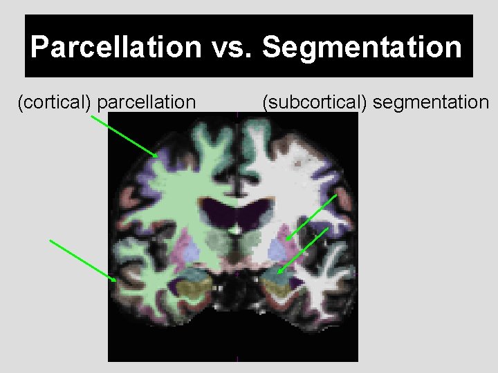 Parcellation vs. Segmentation (cortical) parcellation (subcortical) segmentation 