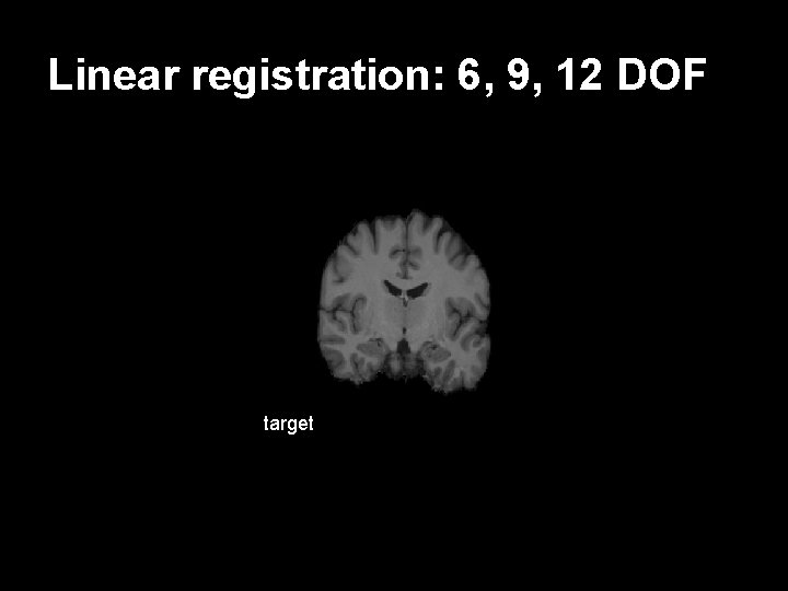 Linear registration: 6, 9, 12 DOF target subject Flirt 9 12 DOF 6 