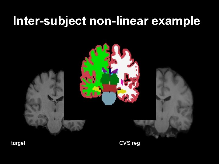 Inter-subject non-linear example target CVS reg 