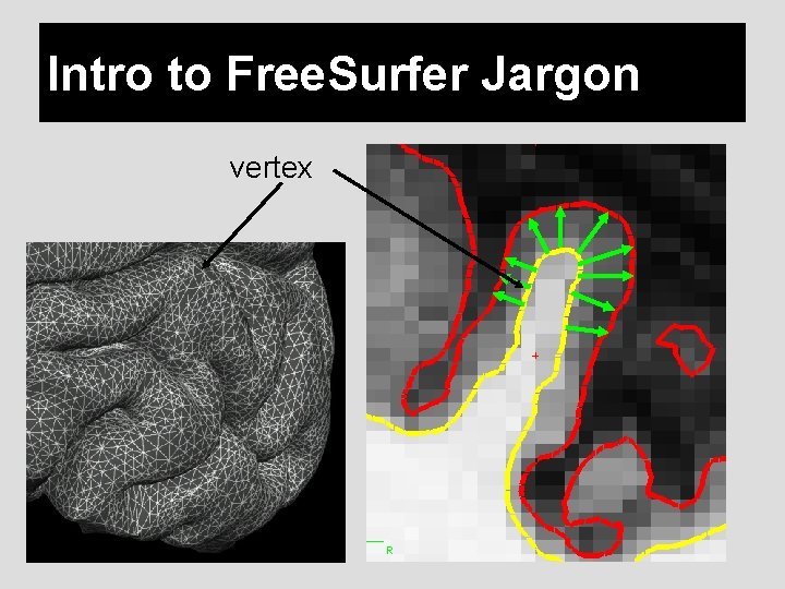 Intro to Free. Surfer Jargon vertex 