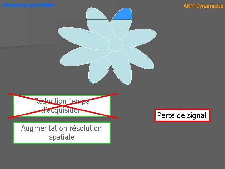 Imagerie parallèle Réduction temps d’acquisition Augmentation résolution spatiale ARM dynamique Perte de signal 