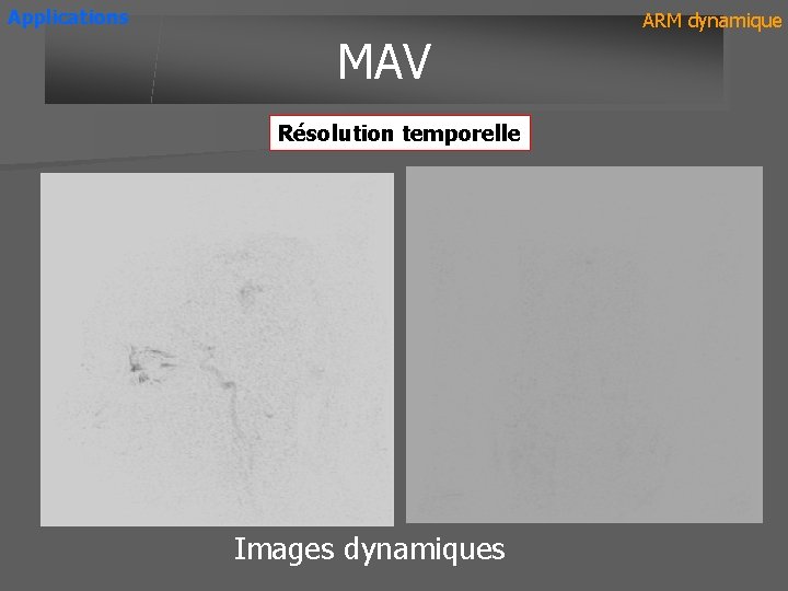 Applications MAV Résolution temporelle Images dynamiques ARM dynamique 