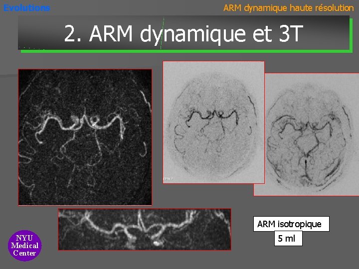 Evolutions ARM dynamique haute résolution 2. ARM dynamique et 3 T ARM isotropique NYU