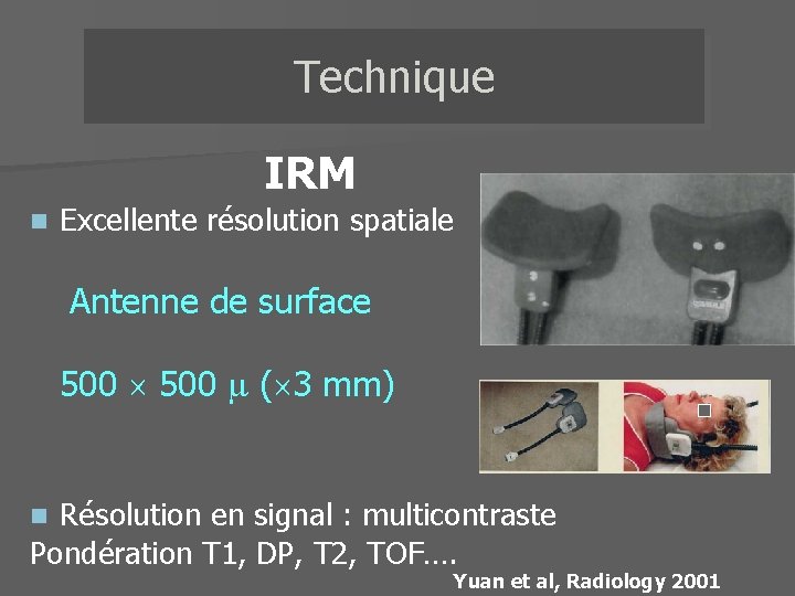Technique IRM n Excellente résolution spatiale Antenne de surface 500 ( 3 mm) Résolution