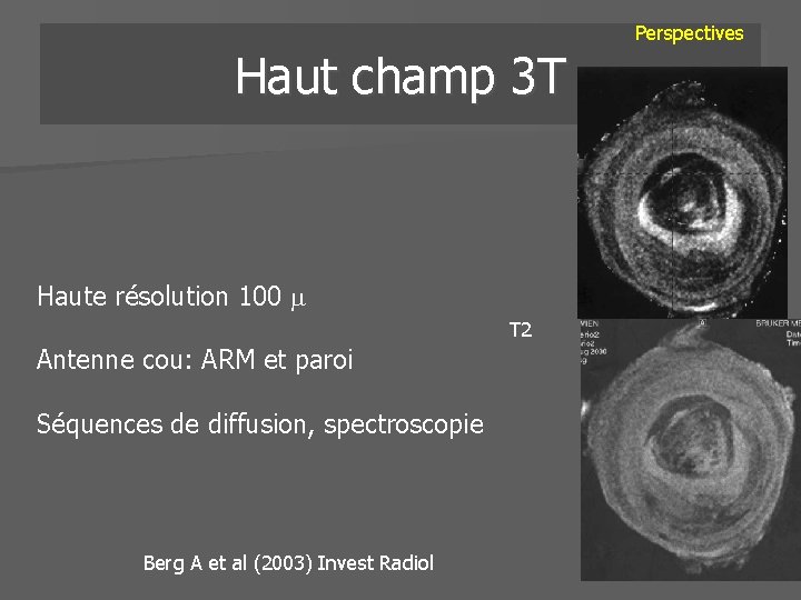 Haut champ 3 T Haute résolution 100 T 2 Antenne cou: ARM et paroi