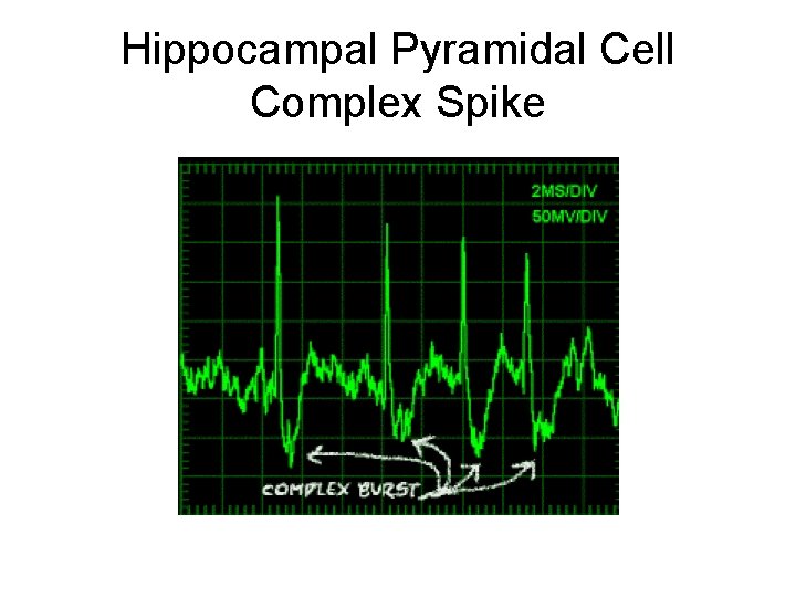 Hippocampal Pyramidal Cell Complex Spike 