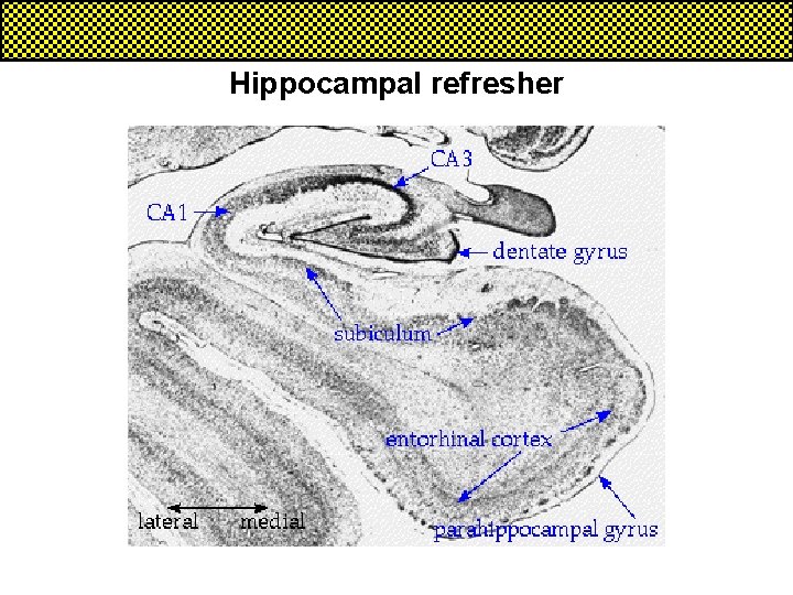 Hippocampal refresher 